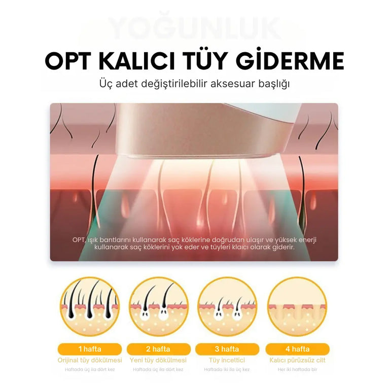 NoTime OPT Profesyonel Buz Lazer Epilasyon - MedEssence