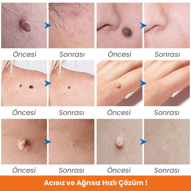 Beauty Pen Sihirli Kalem - MedEssence