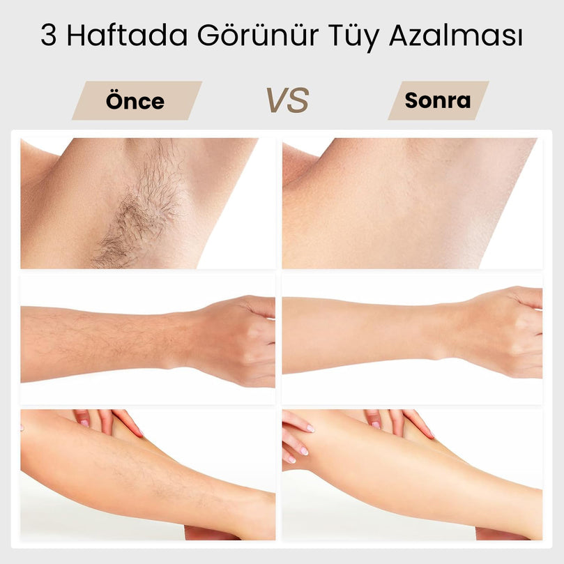 BoSidin Pro OPT Buz Lazer Epilasyon Cihazı - MedEssence