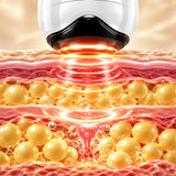 Body Sculp Kavitasyon ve RF Cihazı