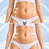 Body Sculp Kavitasyon ve RF Cihazı