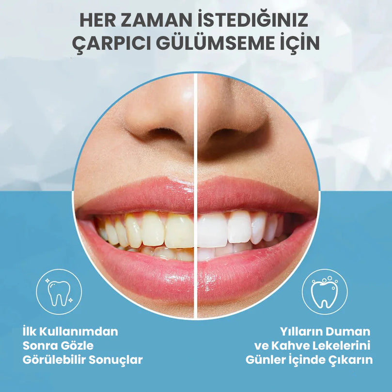 Dent Up - Profesyonel Diş Beyazlatma - MedEssence