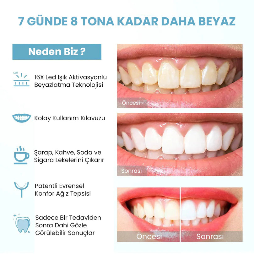 Dent Up - Profesyonel Diş Beyazlatma - MedEssence