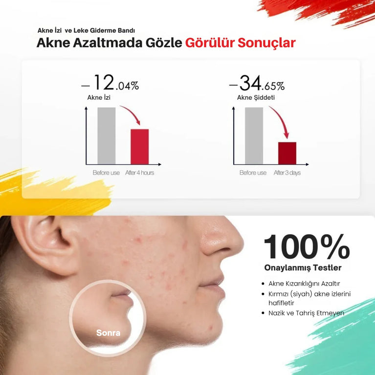 JOVS Acnebye - Sivilce ve Leke Giderici - MedEssence