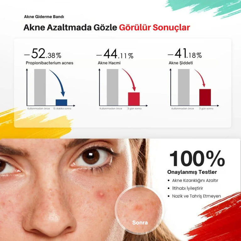 JOVS Acnebye - Sivilce ve Leke Giderici - MedEssence