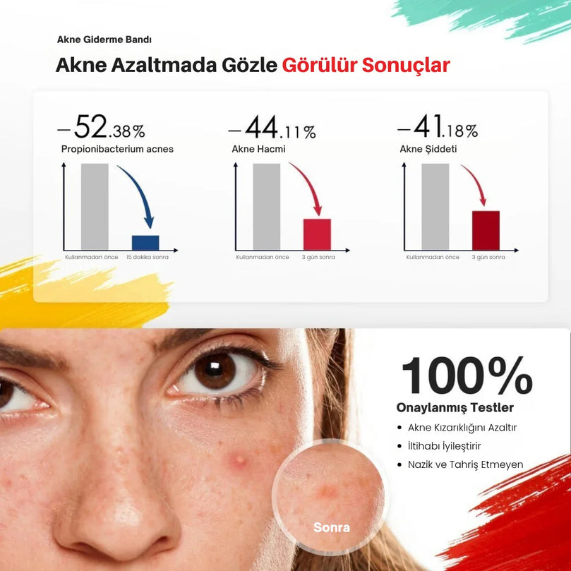 JOVS Acnebye - Sivilce ve Leke Giderici - MedEssence