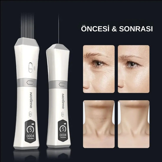 NoTime 9D - Profesyonel Hifu Teknolojisi - MedEssence