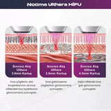 NoTime Ulthera Hifu -  Profesyonel Hifu Teknolojisi - MedEssence