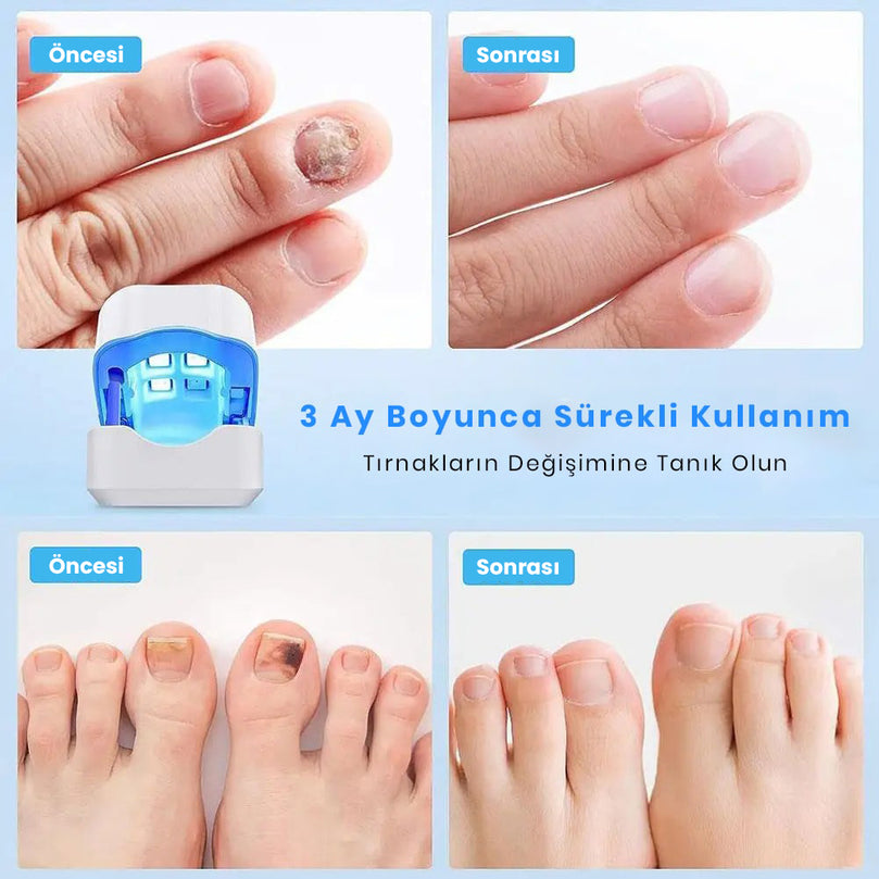 TOE+ Harika Parmaklar - MedEssence